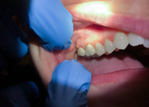 Best Pediatric Emergency Dentist in Seneca, MO